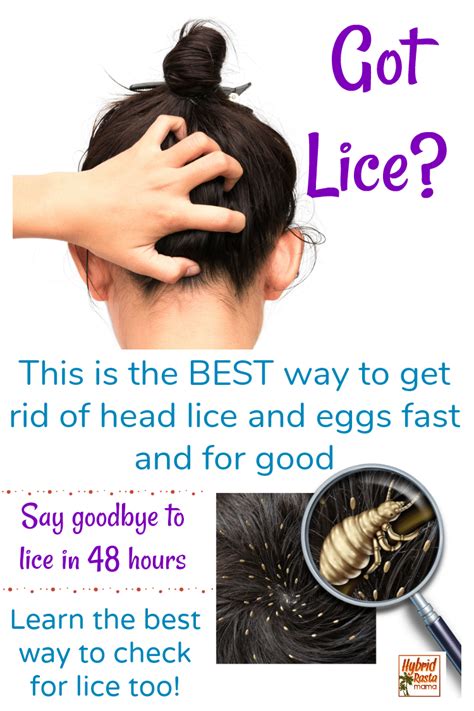 Coconut Oil For Lice Natural Lice Remedies Home Lice Remedies Lice