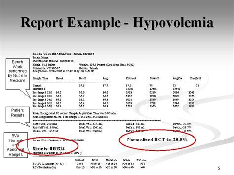 Blood Volume Analysis In Clinical Practice Chris Hirt