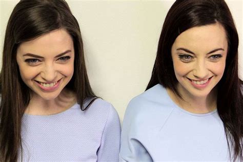 Worlds Most Identical Twins Who Share Everything Including Same