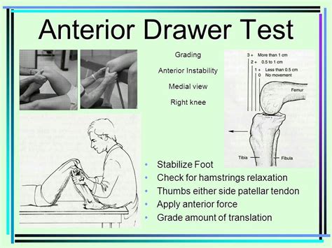 Anterior Drawer Test For Acl Injury Physical Therapy School