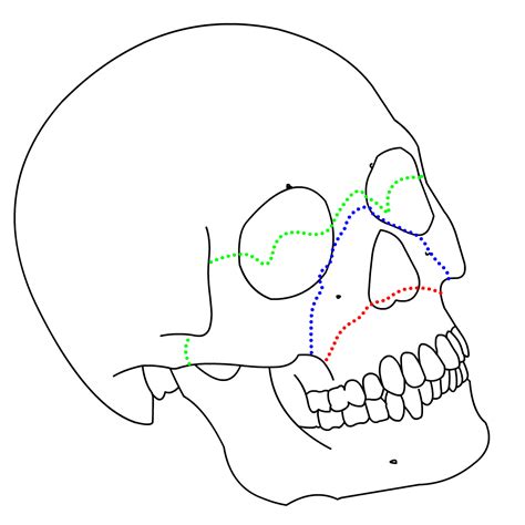 By 411 Advanced Human Anatomy Blog Neuroanatomy Post 6 The Skull