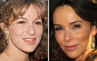 Did Jennifer Grey Plastic Surgery Nose Job Before And After Photos