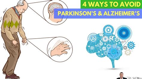 🧠 4 Clinically Proven Ways To Avoid Parkinsons And Alzheimers By Dr