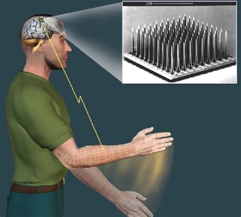 Thought Controlled Prosthetic Limb System To Be Tested On Humans Kurzweil