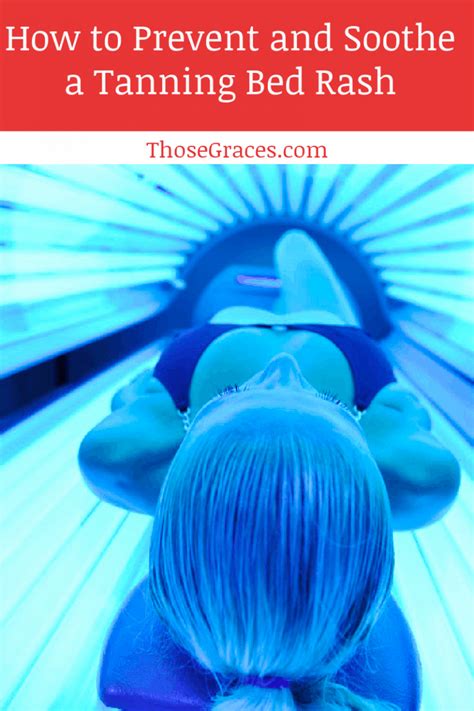 Tanning Bed Rash How To Prevent It And Get Rid Of It