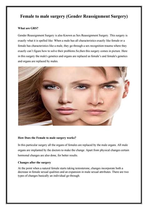 Female To Male Surgery Gender Reassignment Surgery In India By Natvarap19 Issuu