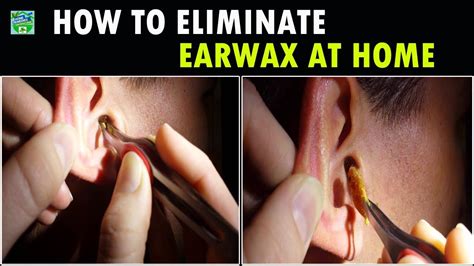 How To Eliminate Earwax At Home Home Remedies Youtube