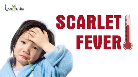 Diy Best Cure For Scarlet Fever With Natural Home Remedies Live