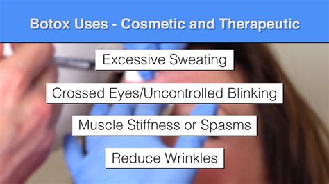 There is a botox insurance coupon for people who suffer from migraines.when life gives you lemons, you can actually get insurance will not cover botox if it is used for cosmetic purposes. Botox - Not Longer Just for Wrinkles | The Plastic Surgery Channel