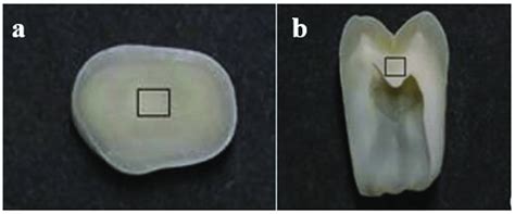 The Sectioned And Cut Samples From The Teeth A The Cross Section Of