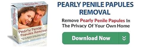 Pearly Penile Papules Removal By Josh Marvin Goodreads