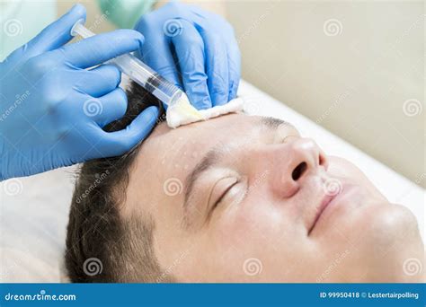 Man Passes A Course Of Mesotherapy Stock Photo Image Of Care Medical