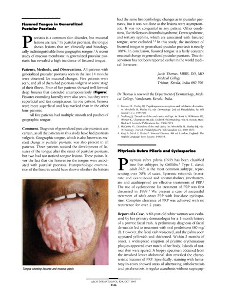 Fissured Tongue In Generalized Pustular Psoriasis Jama Dermatology