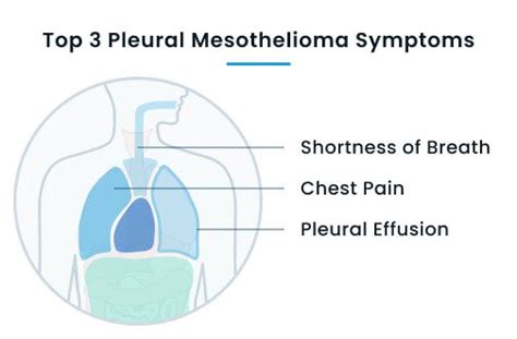 Check spelling or type a new query. Mesothelioma Cancer Symptoms & Early Warning Signs