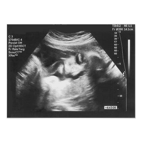 How to make a fake sonogram free. Pin on Ultrasound pictures