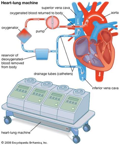 Does the heart rate hit zero when people are on the heart lung. heart-lung machine | medical device | Encyclopedia Britannica
