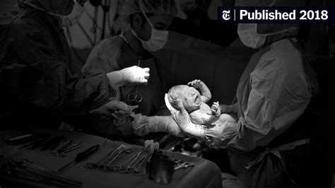 opinion not every c section is a bad birth story the new york times