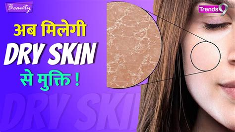 How To Get Rid Of Dry Skin Dry Skin Home Remedies Watch Video Trends9
