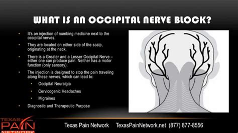 Occipital Blocks For Headaches Explained By A San Antonio Pain Clinic