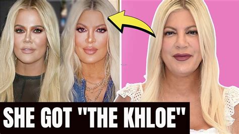 Tori Spelling 90210 Plastic Surgery Khloe Kardashian Inspired