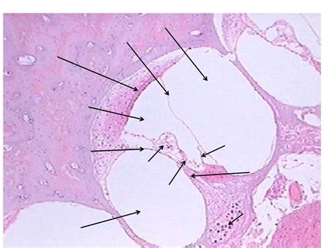 Spiral Organ Of Corti Guinea Pig Cochlea Slide Diagram Quizlet