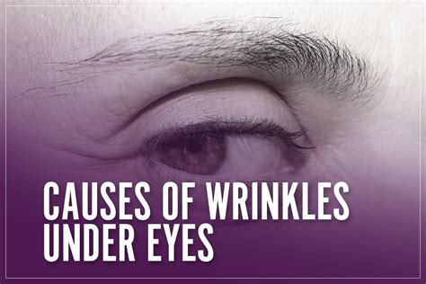 Causes Of Wrinkles Under Eyes Our 2023 Guide To Prevent Them