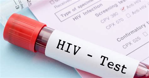 Prävention Aids Bekämpfen Nicht Die Erkrankten Kroneat