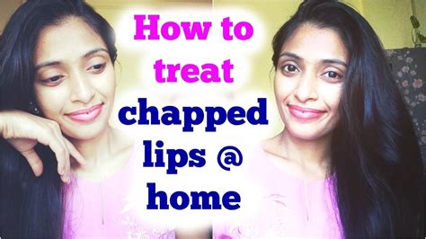 HOW TO TREAT CHAPPED LIPS / EASY HOME REMEDY 