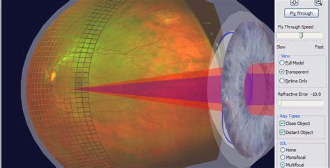 Retinal Imaging At Dvision Dvision Optical Chicago