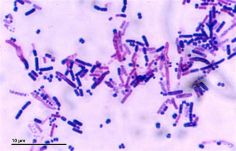 Salmonella infection (salmonellosis) affects the intestinal tract. Difference Between Germs and Bacteria - Pediaa.Com
