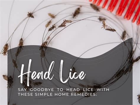 How To Get Rid Of Head Lice With These Trusted Home Remedies