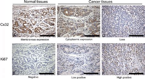 Immunohistochemical Staining For Cx32 And Ki67 In Normal Gastric