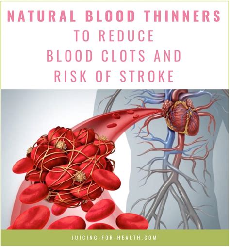 Natural Blood Thinners To Reduce Blood Clots And Risk Of Stroke