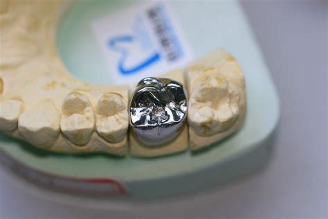 Full Cast Base Metal Alloys Dental Crown