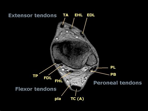 .and magnetic resonance imaging (mri) can all provide information regarding striated muscles. Ankle tendons: topographic anatomy | Image | Radiopaedia.org