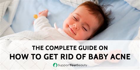 How To Get Rid Of Baby Acne New 2021 Help Your Baby Now Baby