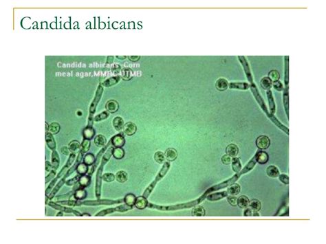 Ppt Candida Albicans Biologia Powerpoint Presentation Free Download
