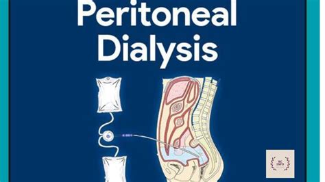 Mcqs Of Peritoneal Dialysis Peritoneal Dialysis Capdapd Ccpd Ipd