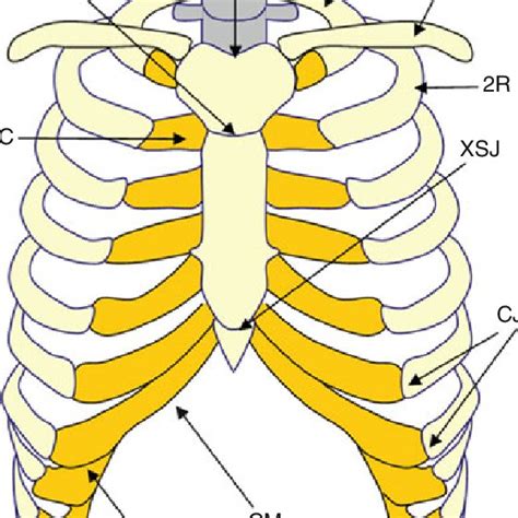 Anatomy Diagram Rib Area Back Pain And Slipped Rib As In The