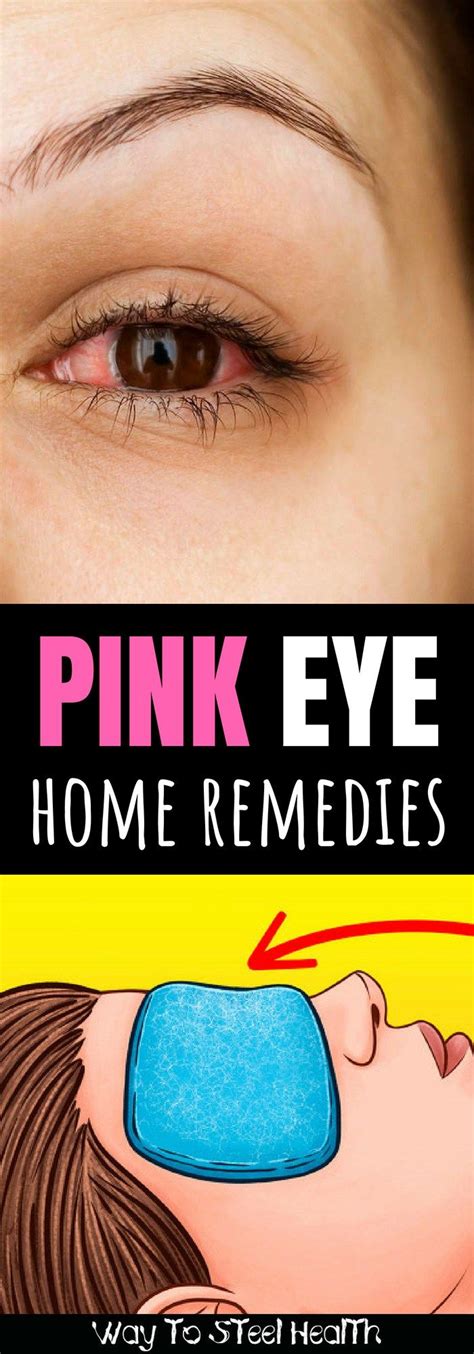 Get Rid Of Pink Eye Fast With These 6 Home Remedies Way To Steel