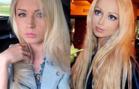 Human Barbie Before And After Plastic Surgery Valeriya Lukyanova Mommy Makeover Mommy