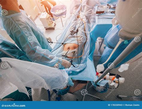 Process Of Gynecological Surgery Operation Using Laparoscopic Equipment Stock Image Image Of