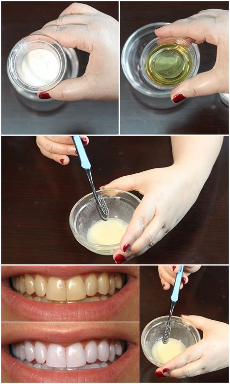 How To Whiten Your Teeth Naturally At Home Quickly And Instantly