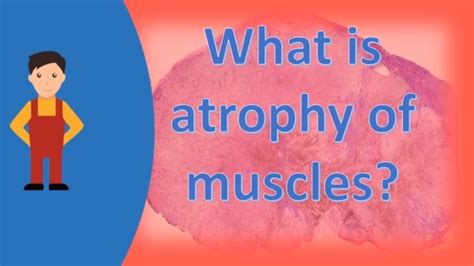 What Is Atrophy Of Muscles Find Health Questions Best Health Tips