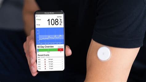 What Is Cgm Continuous Glucose Monitoring Sugarfit