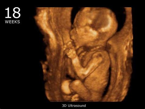 3d 4d Ultrasound Pictures At 18 Weeks Picturemeta
