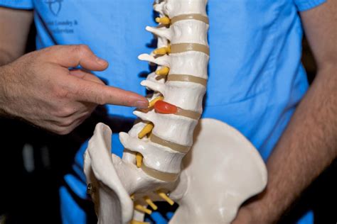 Is Back Pain Normal Heres What You Should Know All Star Chiropractic
