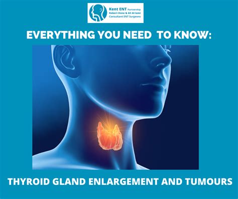 everything you need to know thyroid gland and tumours kent ent partnership