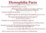 Hemophilia Disease Treatment Pictures