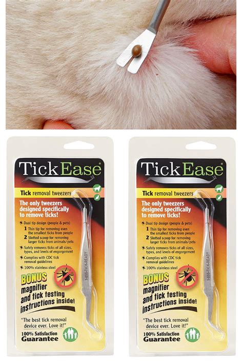 How To Remove S Tick Howtormeov